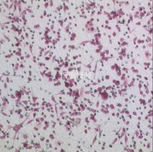 细胞侵袭