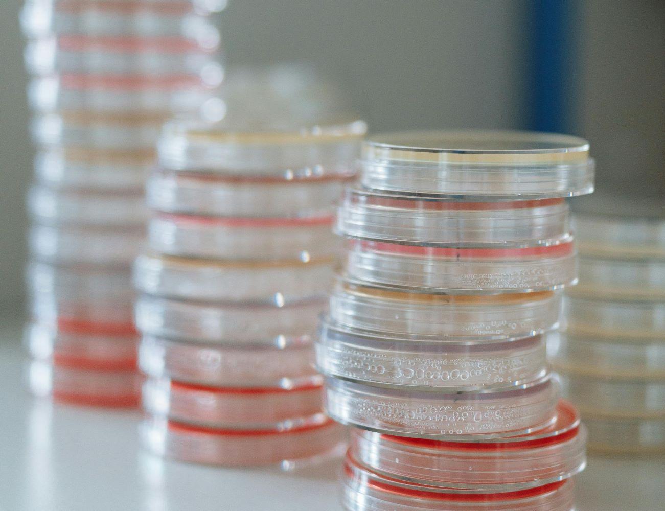 Transwell检测细胞迁移