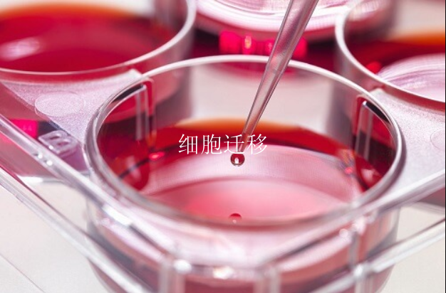 细胞迁移